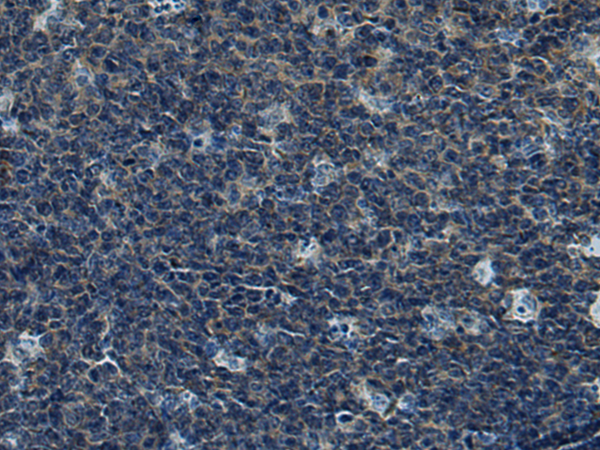 Rabbit Polyclonal Antibody to CUL5