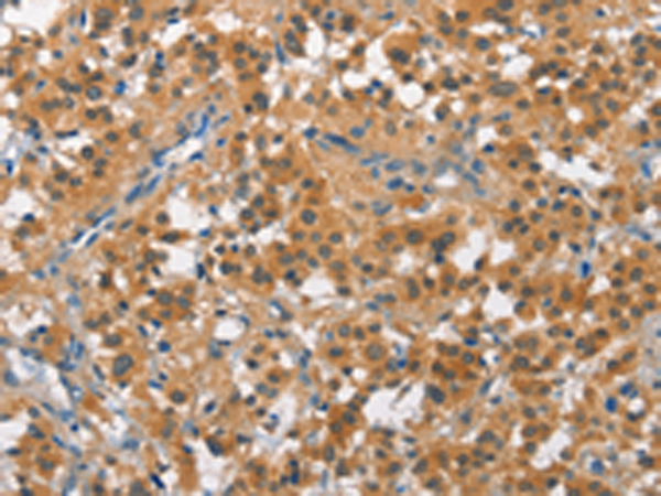 Rabbit Polyclonal Antibody to CUL7