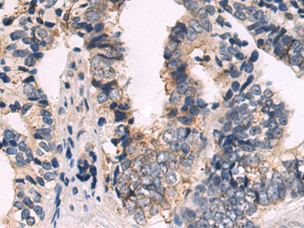 Rabbit Polyclonal Antibody to GJA5