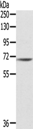 Rabbit Polyclonal Antibody to IL18R1