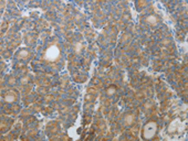 Rabbit Polyclonal Antibody to CXCR3