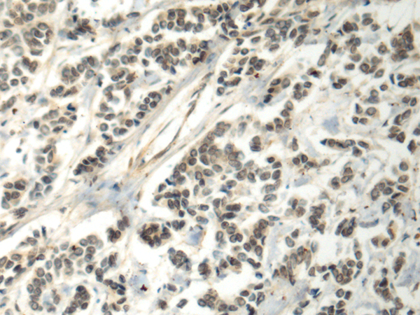 Rabbit Polyclonal Antibody to CCNA1