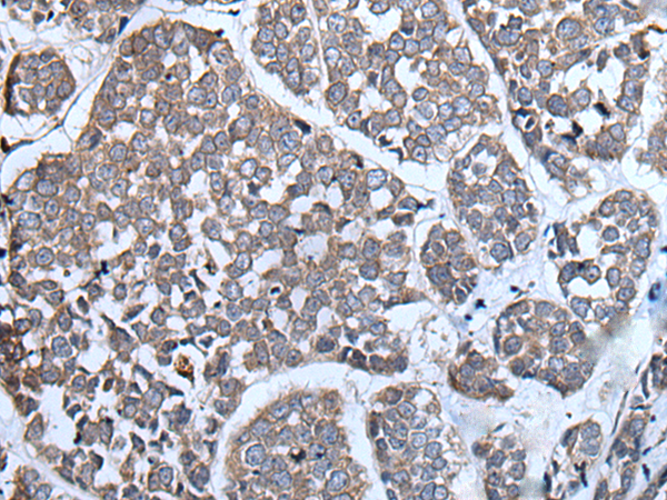Rabbit Polyclonal Antibody to CYGB