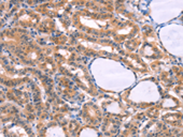Rabbit Polyclonal Antibody to CYP1B1