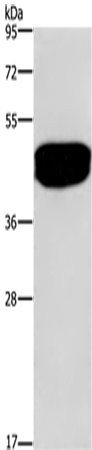 Rabbit Polyclonal Antibody to ENTR1