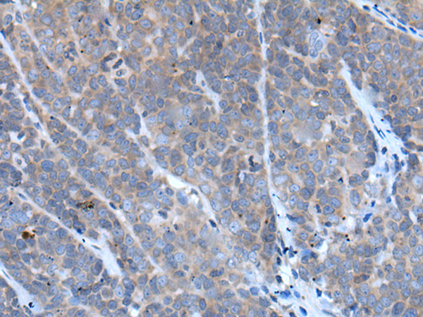 Rabbit Polyclonal Antibody to TNFRSF10C