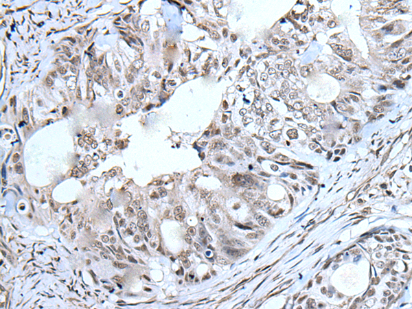 Rabbit Polyclonal Antibody to DDB2