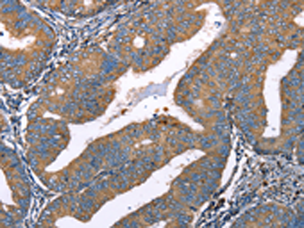 Rabbit Polyclonal Antibody to DEFA1