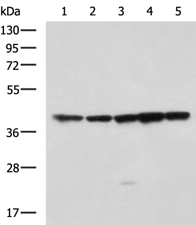 Rabbit Polyclonal Antibody to DAP3