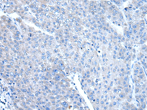 Rabbit Polyclonal Antibody to DAP