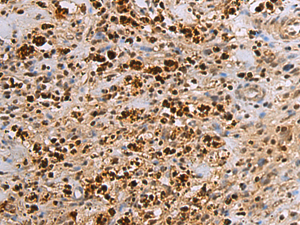 Rabbit Polyclonal Antibody to DTX2