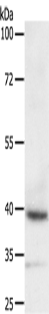 Rabbit Polyclonal Antibody to DTX3
