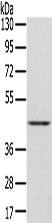 Rabbit Polyclonal Antibody to DLK1