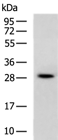Rabbit Polyclonal Antibody to DKK1