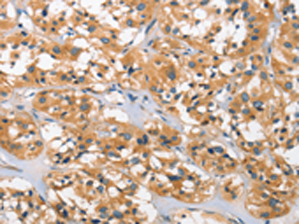 Rabbit Polyclonal Antibody to DKK3