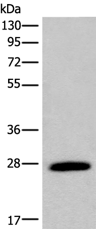 Rabbit Polyclonal Antibody to DKKL1