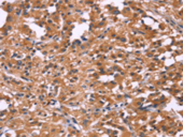 Rabbit Polyclonal Antibody to DKK4