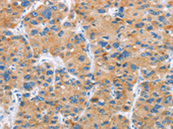 Rabbit Polyclonal Antibody to DKK2