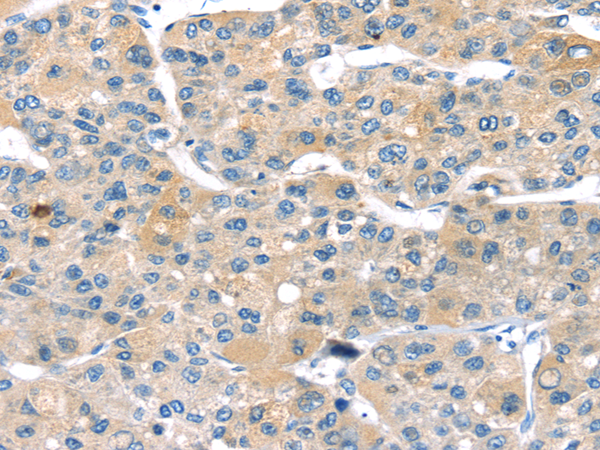 Rabbit Polyclonal Antibody to DNMT3L
