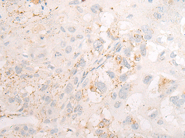 Rabbit Polyclonal Antibody to DOK4