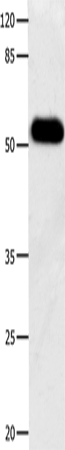 Rabbit Polyclonal Antibody to DOK3
