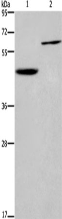 Rabbit Polyclonal Antibody to DOK1