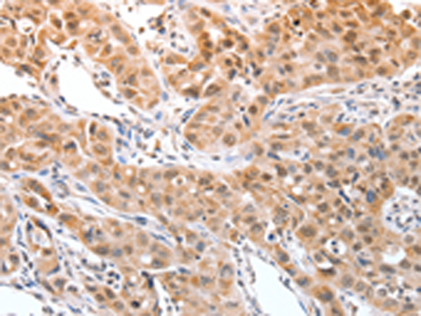 Rabbit Polyclonal Antibody to DPPA2