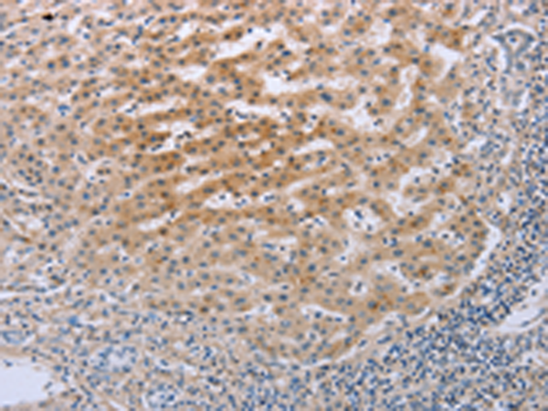 Rabbit Polyclonal Antibody to TNFRSF25