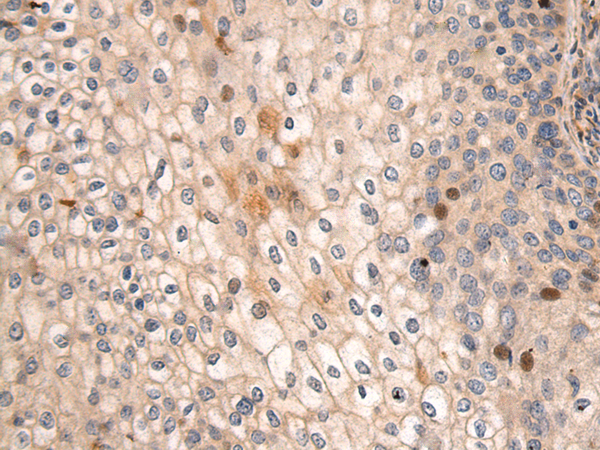 Rabbit Polyclonal Antibody to EGF