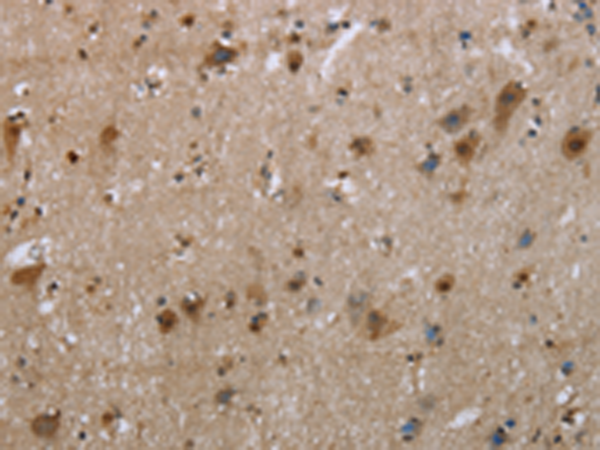 Rabbit Polyclonal Antibody to EGFL8