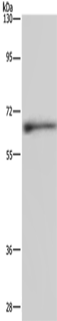 Rabbit Polyclonal Antibody to ELN