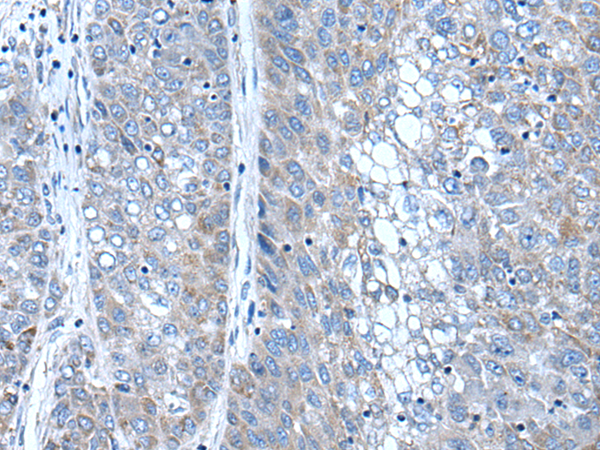 Rabbit Polyclonal Antibody to SFRP4