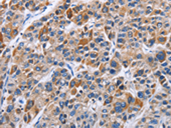 Rabbit Polyclonal Antibody to ENPP5
