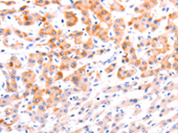 Rabbit Polyclonal Antibody to EFNA1