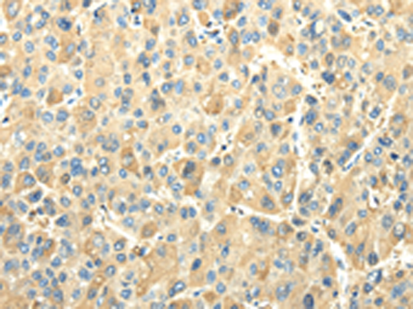 Rabbit Polyclonal Antibody to EFNA3