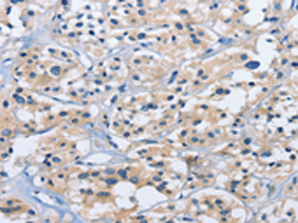 Rabbit Polyclonal Antibody to DUSP19