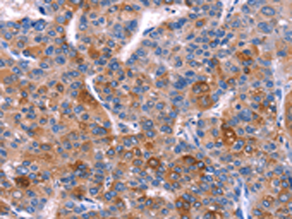 Rabbit Polyclonal Antibody to DUSP13