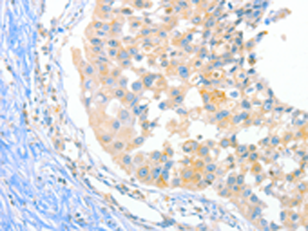 Rabbit Polyclonal Antibody to DUSP14