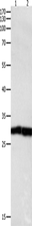 Rabbit Polyclonal Antibody to DUSP6