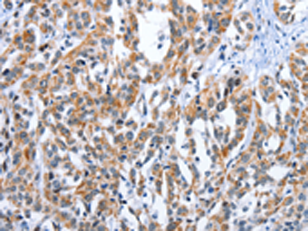 Rabbit Polyclonal Antibody to EDN3