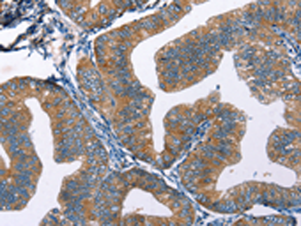 Rabbit Polyclonal Antibody to EDN2