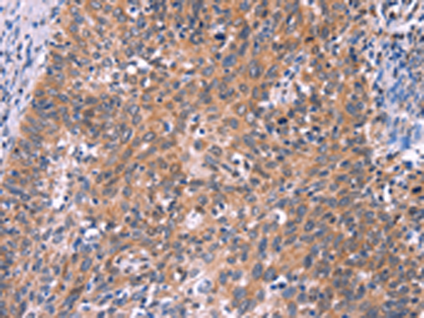 Rabbit Polyclonal Antibody to EDN1