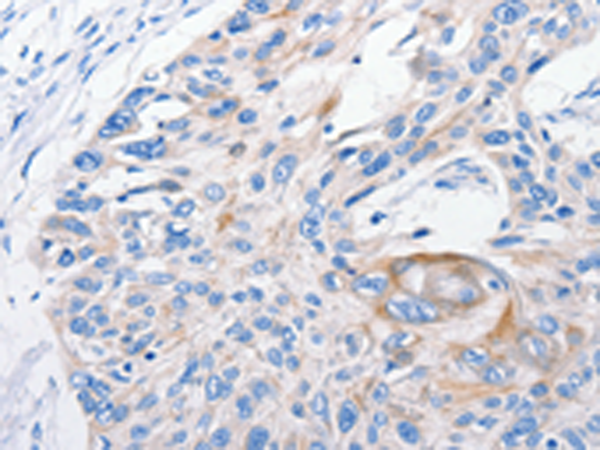 Rabbit Polyclonal Antibody to FANCF