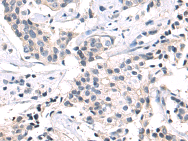 Rabbit Polyclonal Antibody to FGFR1