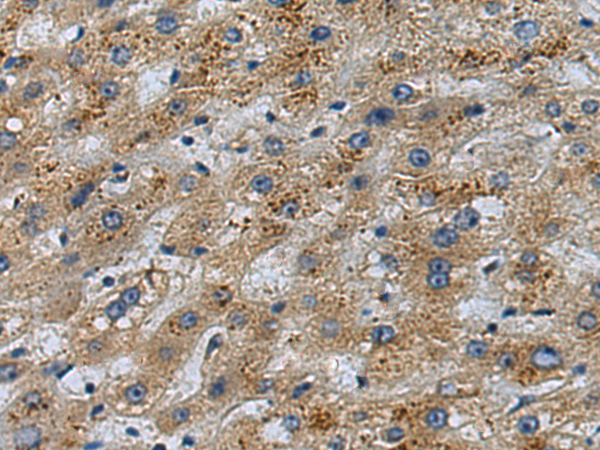 Rabbit Polyclonal Antibody to FOXS1