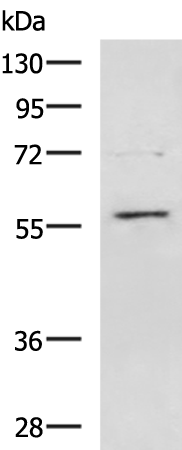 Rabbit Polyclonal Antibody to TBX22