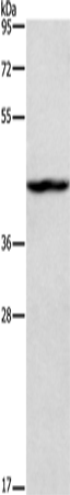 Rabbit Polyclonal Antibody to TBX20