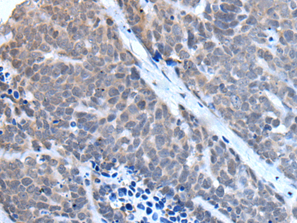 Rabbit Polyclonal Antibody to TBX6