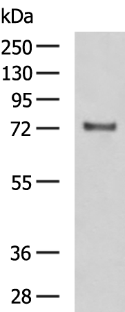 Rabbit Polyclonal Antibody to FSHR
