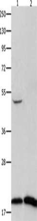Rabbit Polyclonal Antibody to FHIT